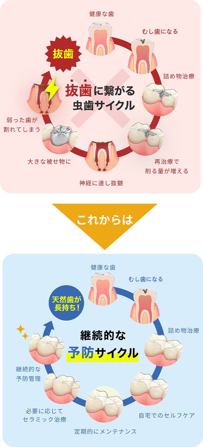 抜歯に繋がるむし歯サイクル これからは 継続的な予防サイクル